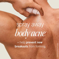 Ultimate Acne Solutions Routine