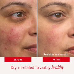 Soothe + Protect Duo